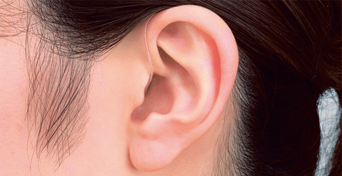 RIC 312 D（MRB2D）装着イメージ